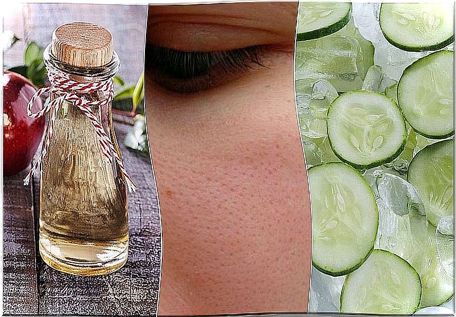 6 natural remedies you can use to close open pores