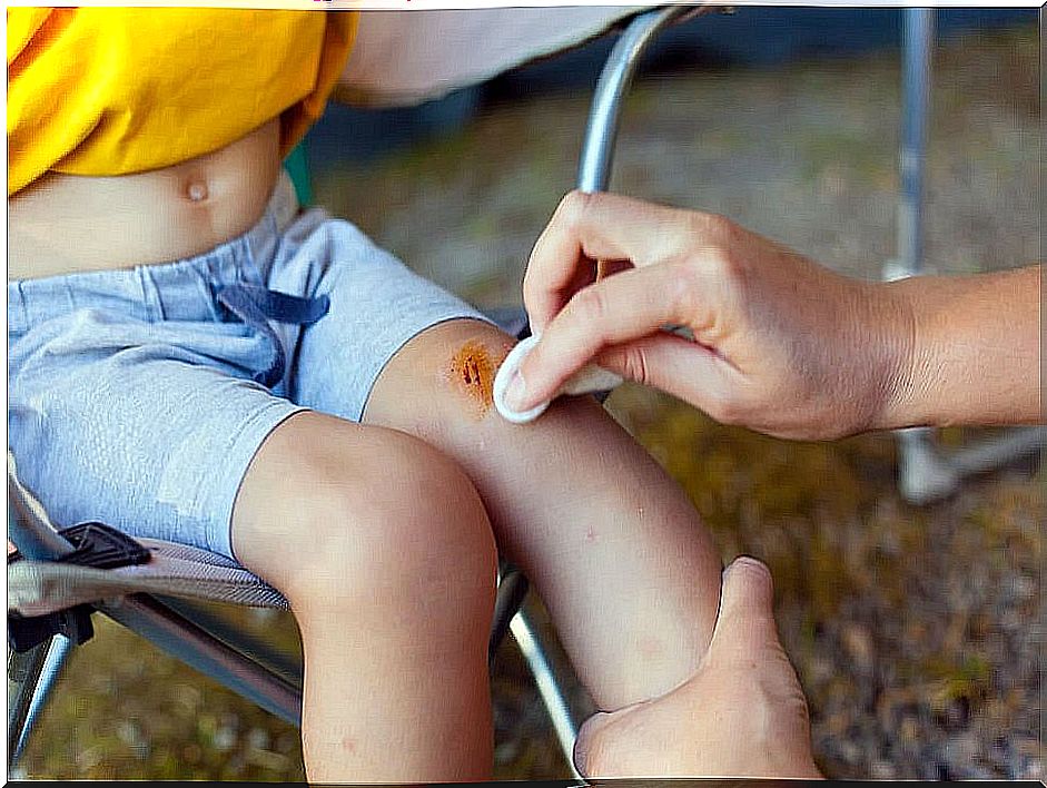 Infected wound of children.