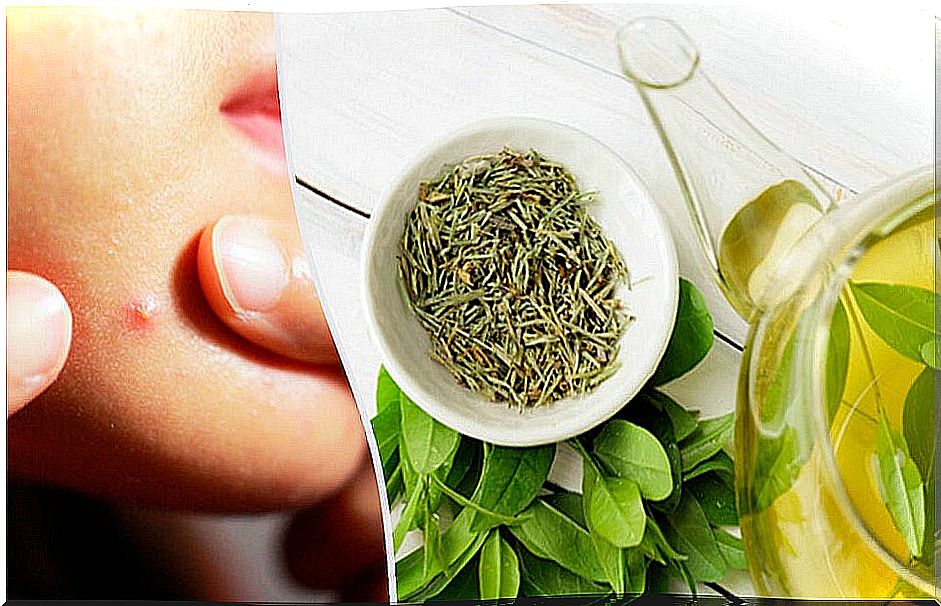 6 tonics and masks with green tea to fight acne