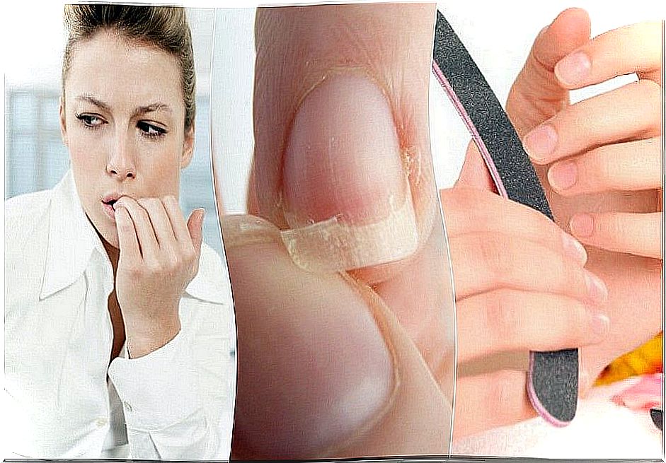 8 reasons why you have brittle nails