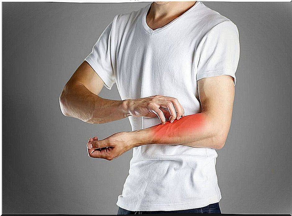 Man-scratching-symptom-of-eczema