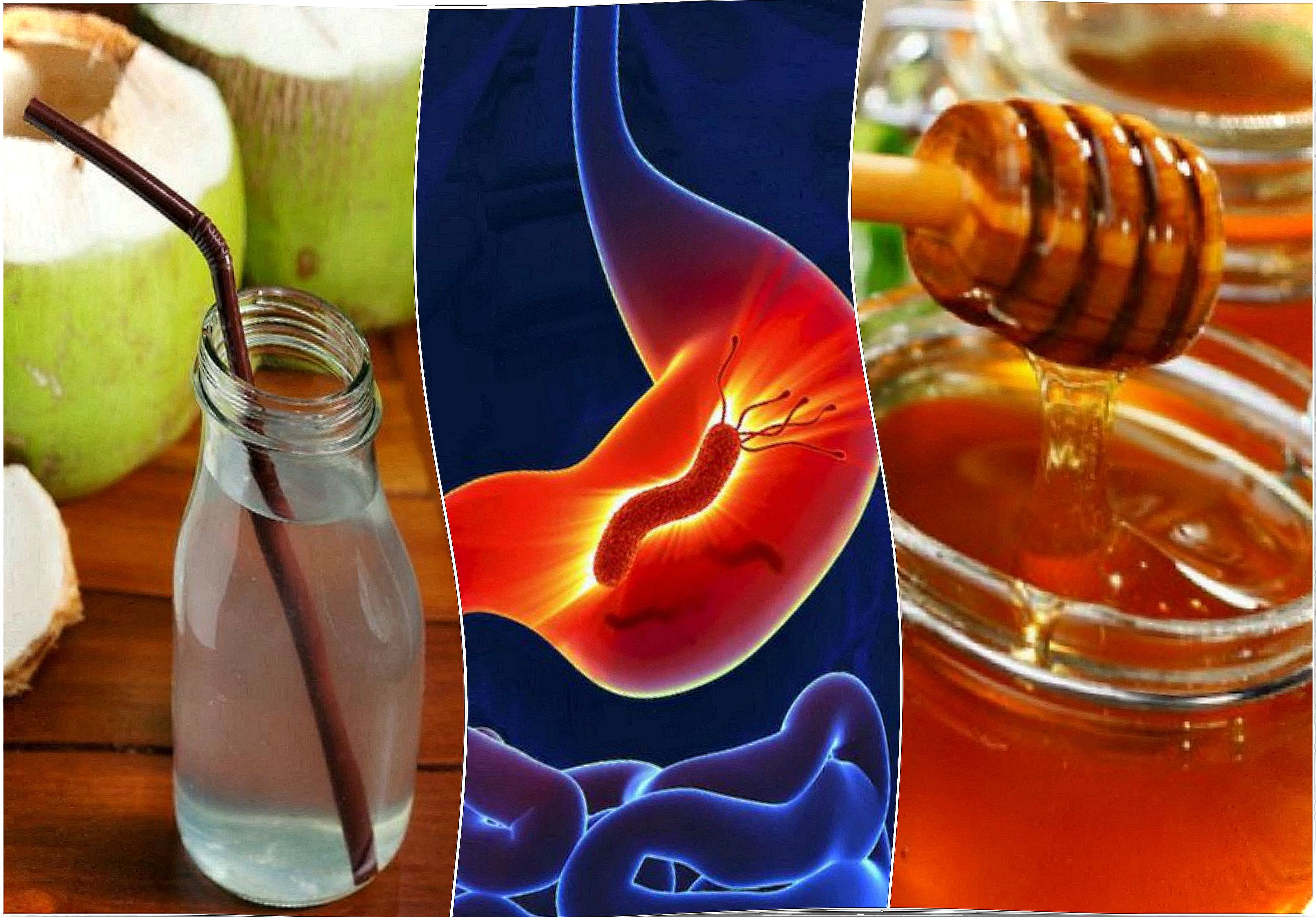 How to fight gastritis with 7 natural remedies