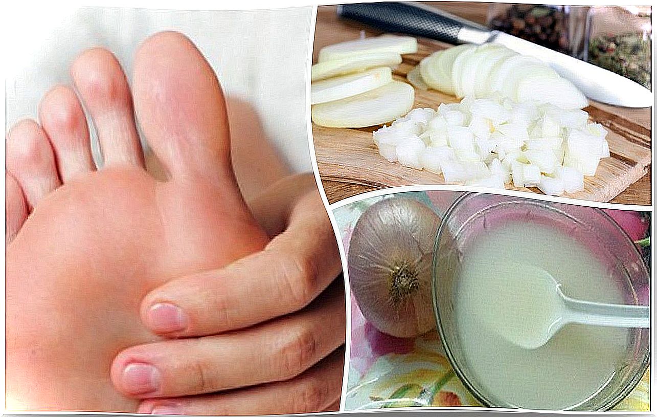 Say goodbye to calluses on your feet by combining two natural ingredients