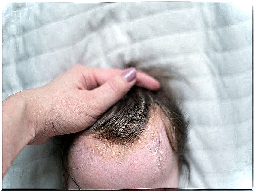 Cradle cap, one of the common irritations on baby's skin