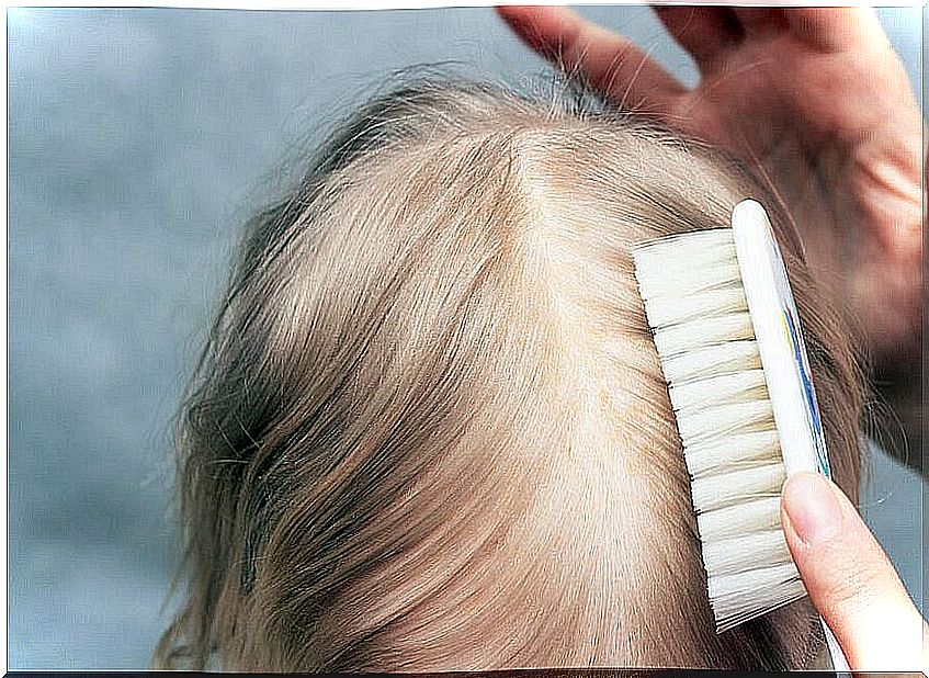 Combing head of a girl with cradle cap