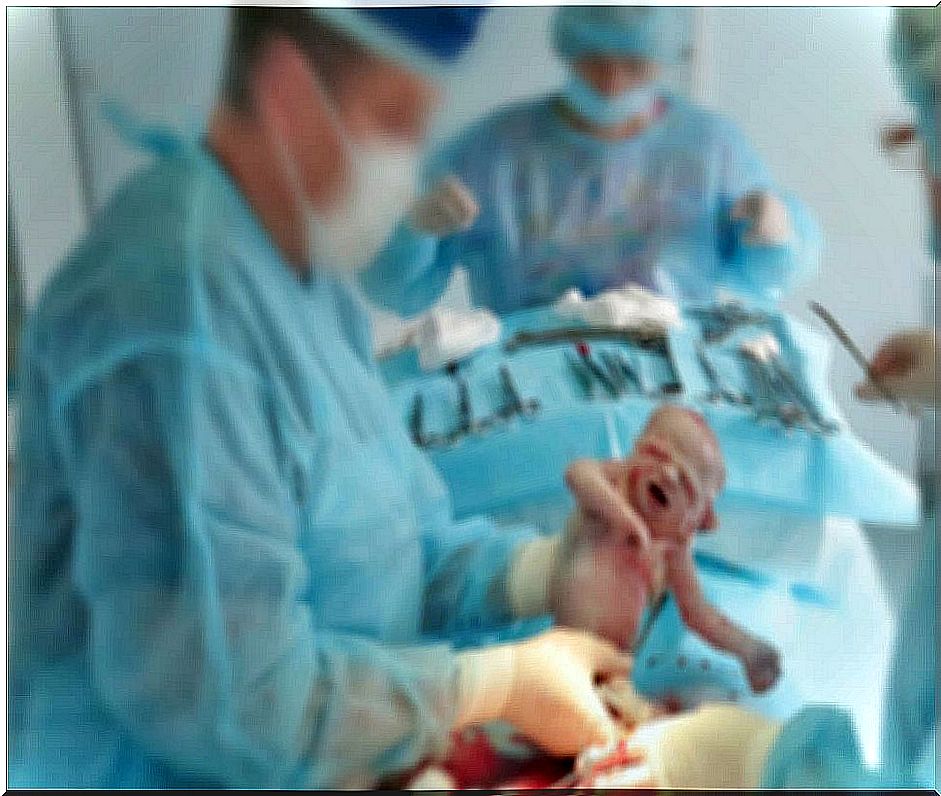 Delivery in the operating room in which the newborn is blurred.  Surgical diseases.