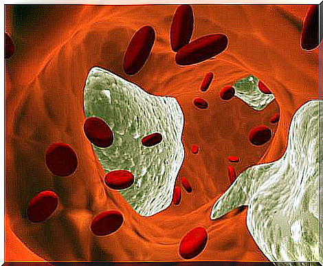 Cholesterol-in-the-blood